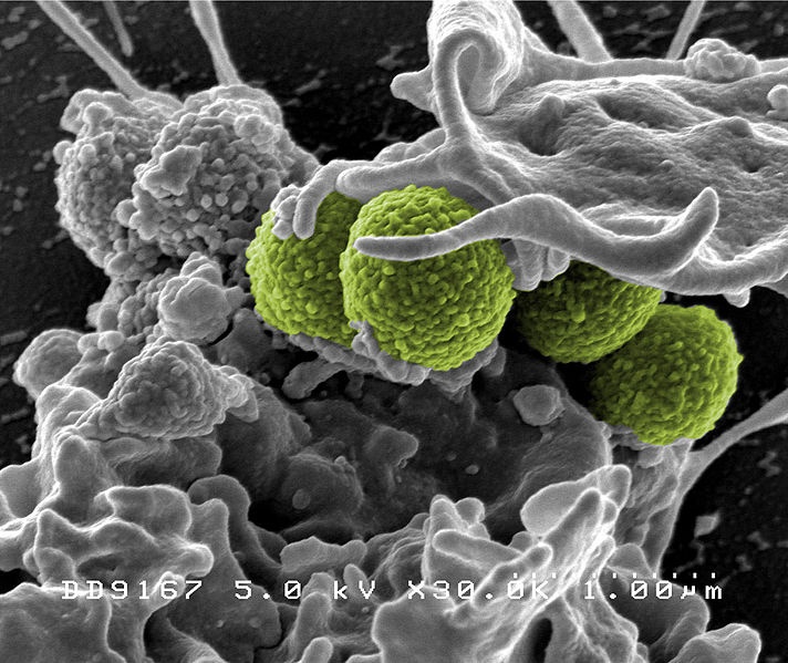 712px-Hospital-associated_Methicillin-resistant_Staphylococcus_aureus_(MRSA)_Bacteria.jpg